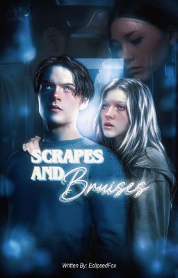 Scrapes & Bruises ༊*·˚ Liam Dunbar